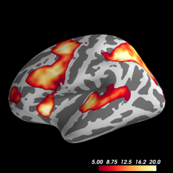 ../_images/sphx_glr_plot_fmri_activation_thumb.png