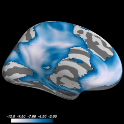 ../_images/sphx_glr_plot_fmri_activation_volume_thumb.png
