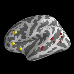 ../_images/sphx_glr_plot_foci_thumb.png