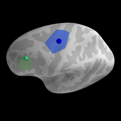 ../_images/sphx_glr_plot_label_foci_thumb.png