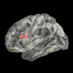 ../_images/sphx_glr_plot_transparent_brain_thumb.png