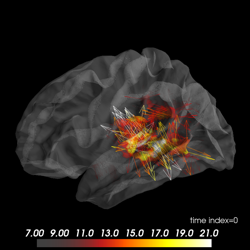 ../_images/sphx_glr_plot_vector_meg_inverse_solution_thumb.png